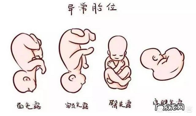 孕检时发现胎位不正怎么办?