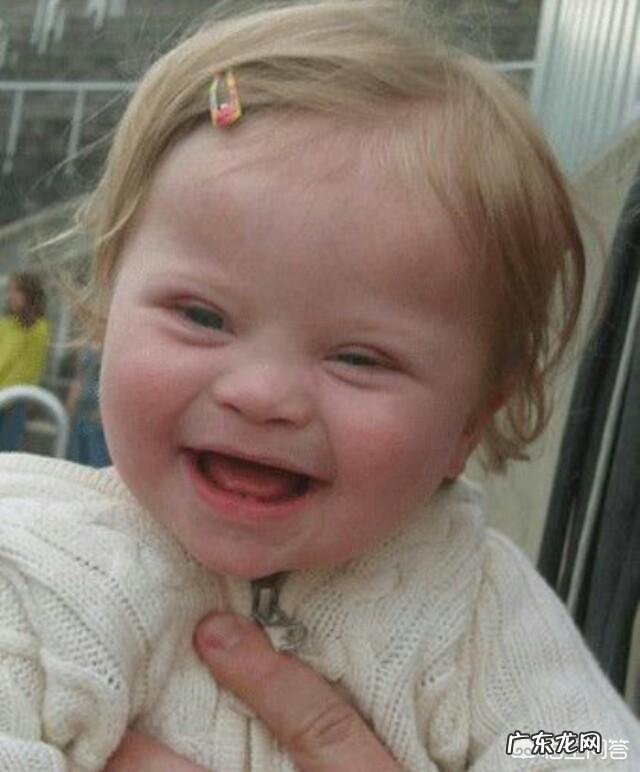 唐氏综合症有什么特征?如何辨别宝宝是不是唐氏综合症?