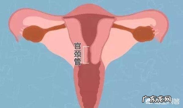 宫颈炎是如何导致不孕?