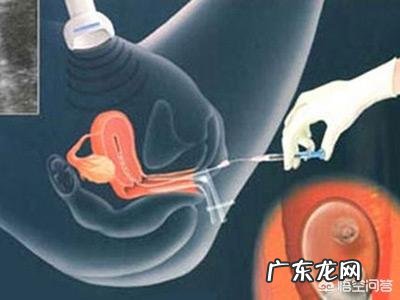 做试管婴儿的流程是怎样的？