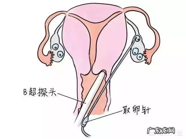 做试管婴儿的流程是怎样的?