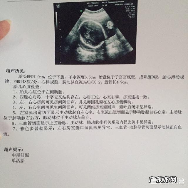 孕妇的B超单是怎么看的呀?