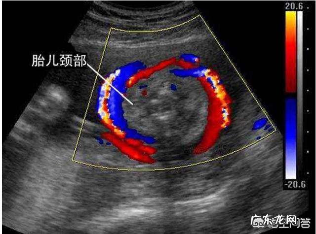孕妇的B超单是怎么看的呀?