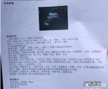孕妇的B超单是怎么看的呀？