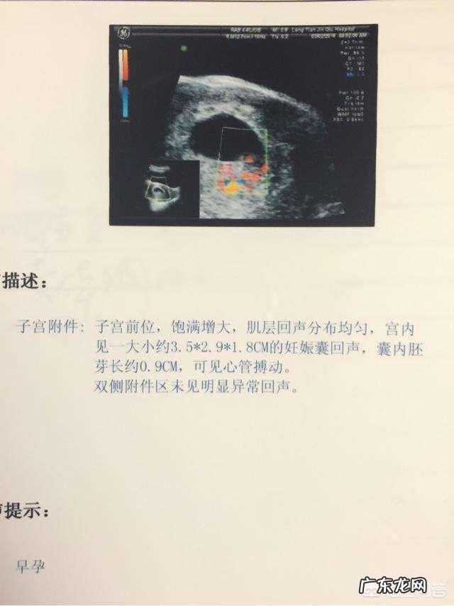 孕妇的B超单是怎么看的呀?