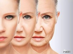 眼角皱纹如何去除