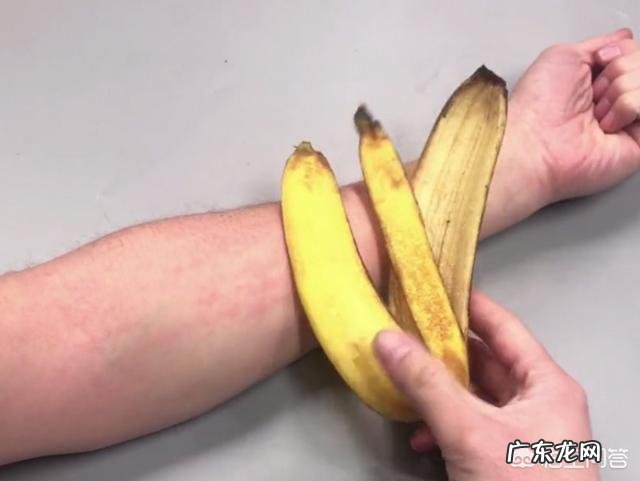 香蕉皮有什么用处?
