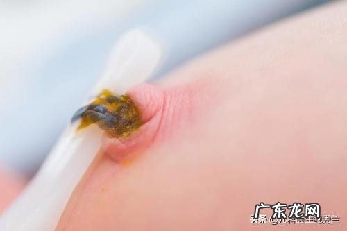 新生儿的脐带应该如何护理,需要注意啥?