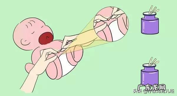 新生儿的脐带应该如何护理,需要注意啥?