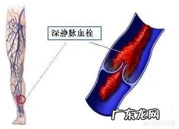 青春痘能够根治吗?