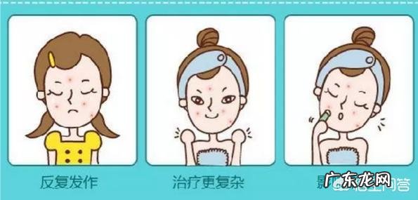 青春痘能够根治吗?