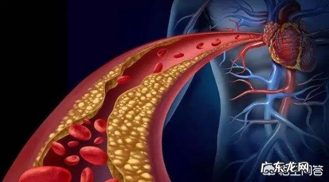 胆固醇高,不能吃什么?