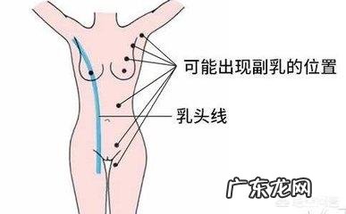 女性的副乳是什么？它会癌变吗？怎么去除副乳呢？
