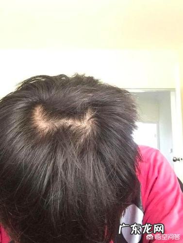 农村俗语:说“双顶男孩找不到,双顶女孩没人要”,双顶是啥?有啥讲究?