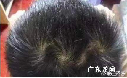 农村俗语:说“双顶男孩找不到,双顶女孩没人要”,双顶是啥?有啥讲究?