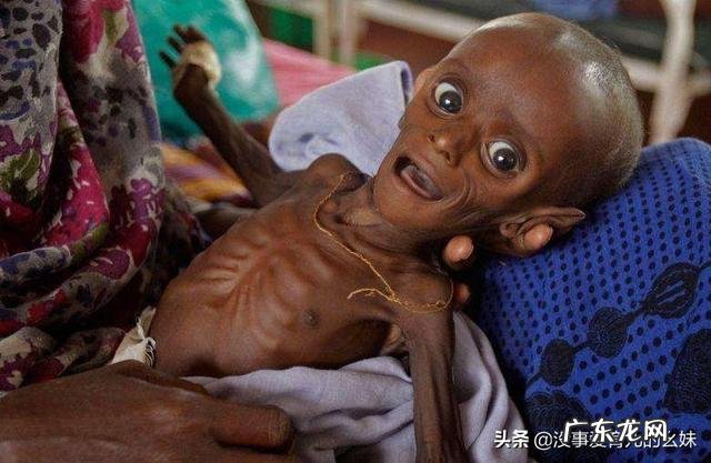 孩子营养不良怎么办?