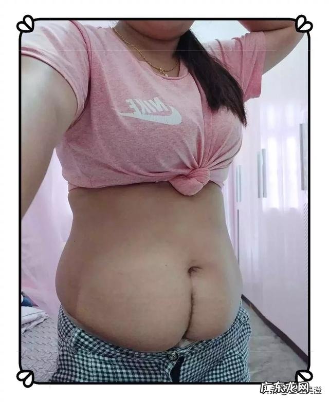 剖腹产风险大?不过剖腹产也有好处,是顺产不能比的,是那些?