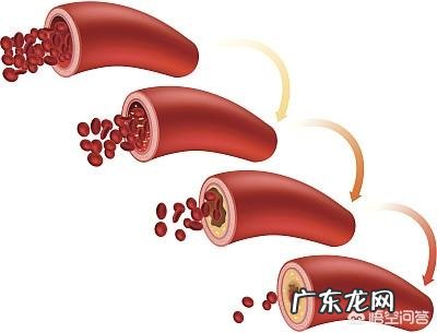 再生障碍性贫血好治吗?如何治?