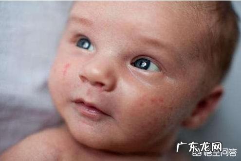 宝宝湿疹是怎么引起的,该怎样缓解?