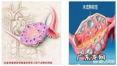 卵巢卵泡太多,营养不够,不能形成成熟的卵子,该补充哪些营养?