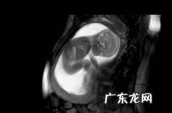 第一胎怀孕一般什么时候会有胎动?有哪些注意事项?