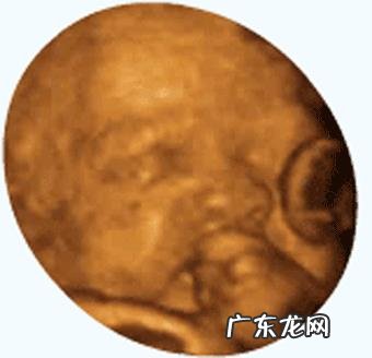 第一胎怀孕一般什么时候会有胎动?有哪些注意事项?