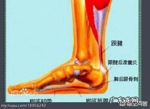 脚后跟痛怎么锻炼?