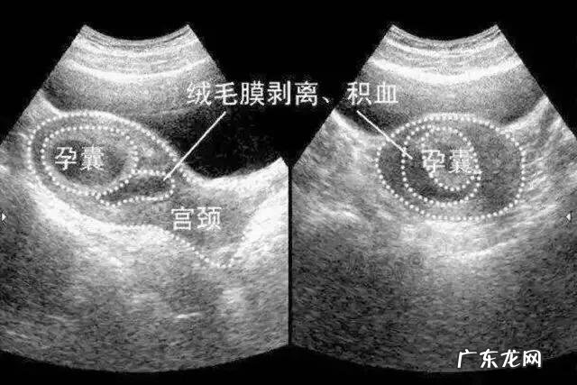 怀孕9周,有什么需要注意的事项?