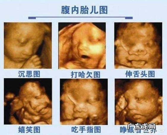 孕妇做四维彩超什么时候做?费用要多少?