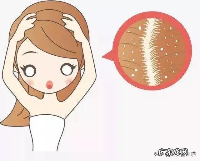 为什么洗发精都洗不掉头屑?广告上打广告又说可以洗掉头屑?
