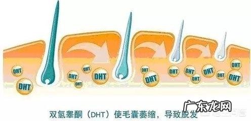 秃顶是不是不会遗传给女孩?