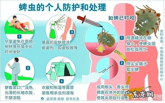 被蜱虫叮咬后,如何安全取下蜱虫?