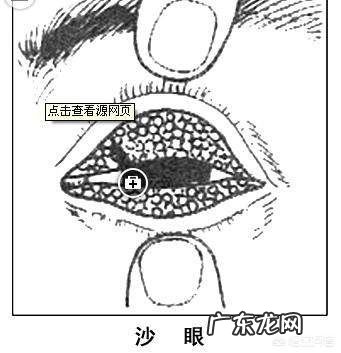 衣原体感染是什么意思?