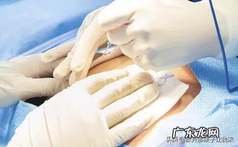 第一胎剖腹产,二胎想顺产需要注意什么?还是必须得剖腹产呢?