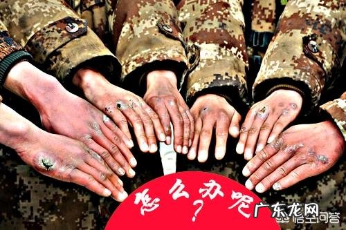 手生冻疮有啥方法快速消除?