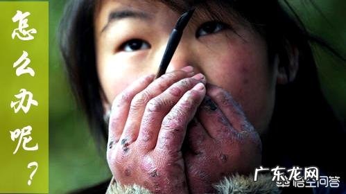 手生冻疮有啥方法快速消除?