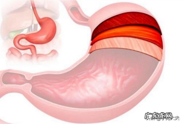 老有反酸烧心是怎么回事?
