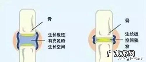 孩子发育慢，个子比较矮，应该怎么办？