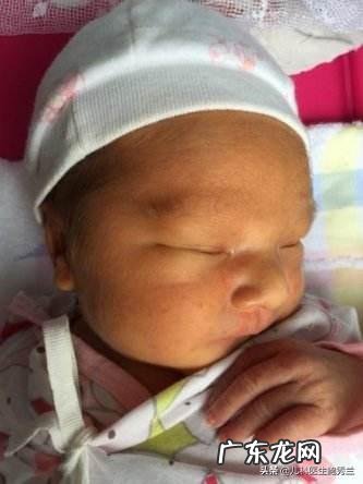新生儿10个有9个黄疸,如何快速去黄疸?