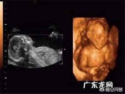 怀孕在医院里做的二维、三维、四维彩超，都有什么区别？