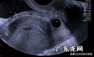 疤痕妊娠会导致胎停吗?怎么通过B超看是不是疤痕妊娠?