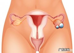 卵巢癌晚期如何减轻痛苦？