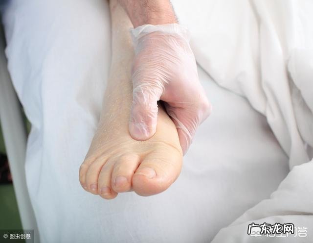 怎么区分水肿和胖?