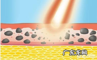 有色素型黑眼圈怎么办?