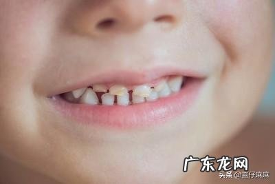 如何预防宝宝蛀牙？