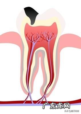 如何预防宝宝蛀牙？
