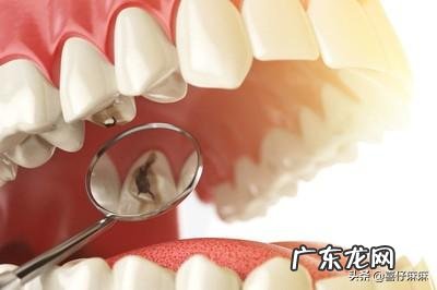 如何预防宝宝蛀牙？