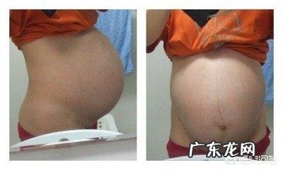 如何判断胎儿是否入盆？