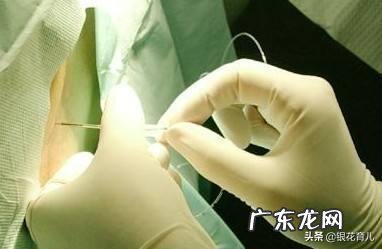 剖腹产哪一步最疼?剖腹产要经历哪些痛?