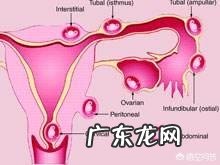 为什么有些人会发生宫外孕的情况？应该怎么办？